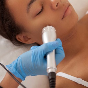 Microdermabrasion