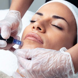 Virtue RF Microneedling