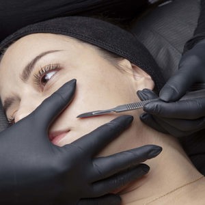 Dermaplaning